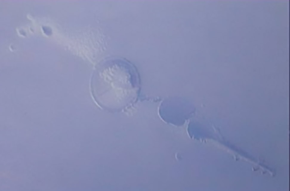 360-1-困气：注塑时带入空气